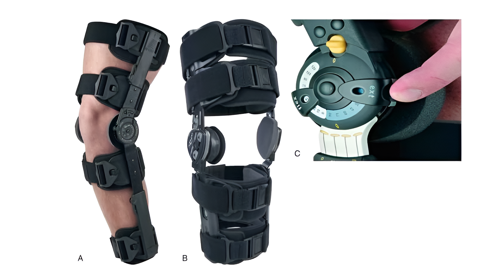 Custom Knee Bracing in Toronto